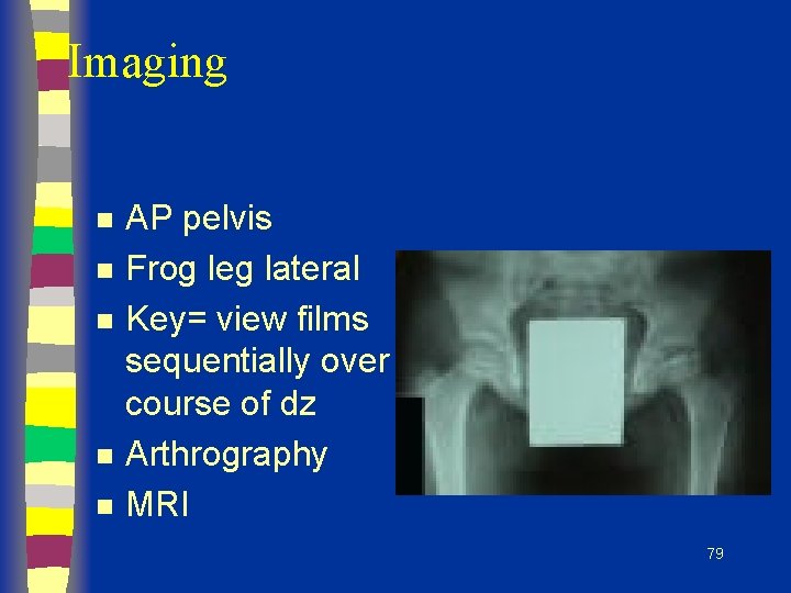 Imaging n n n AP pelvis Frog leg lateral Key= view films sequentially over