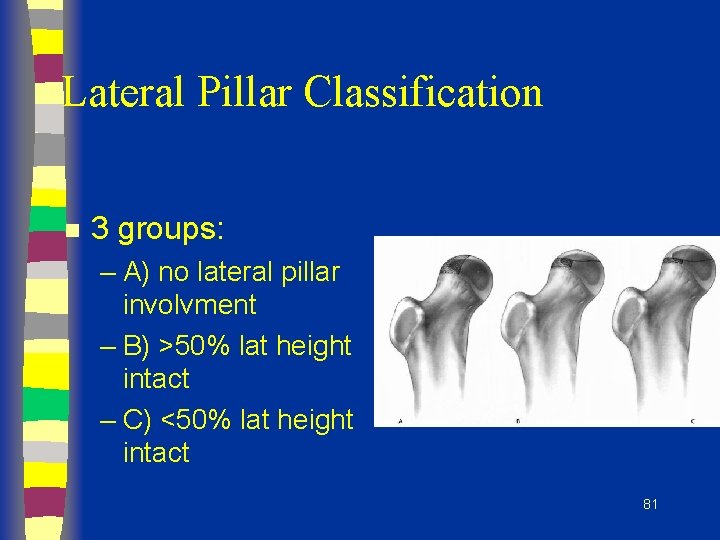 Lateral Pillar Classification n 3 groups: – A) no lateral pillar involvment – B)