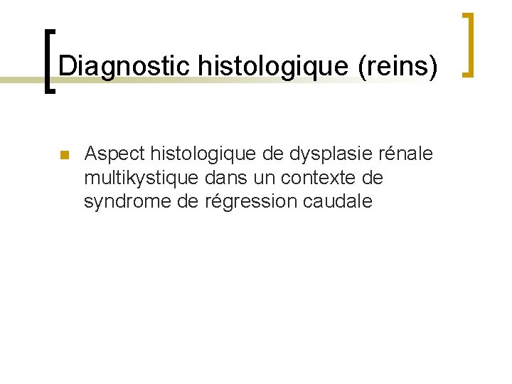 Diagnostic histologique (reins) n Aspect histologique de dysplasie rénale multikystique dans un contexte de
