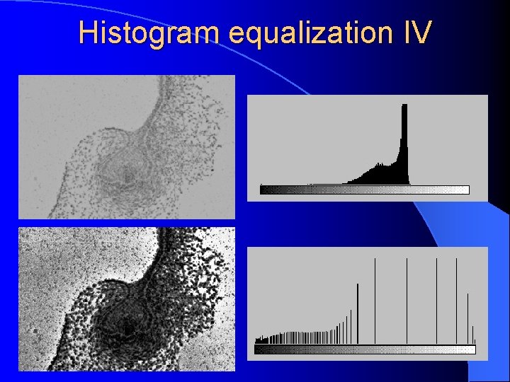  Histogram equalization IV 