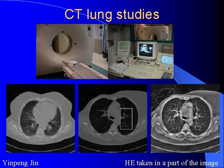 CT lung studies Yinpeng Jin HE taken in a part of the image 