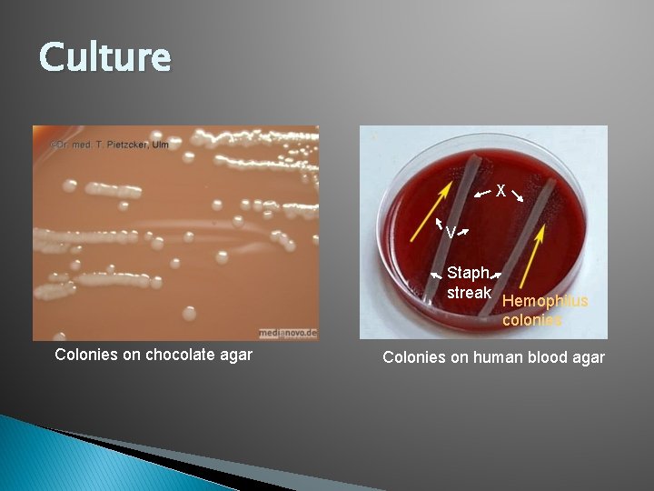 Culture X V Staph streak Colonies on chocolate agar Hemophilus colonies Colonies on human