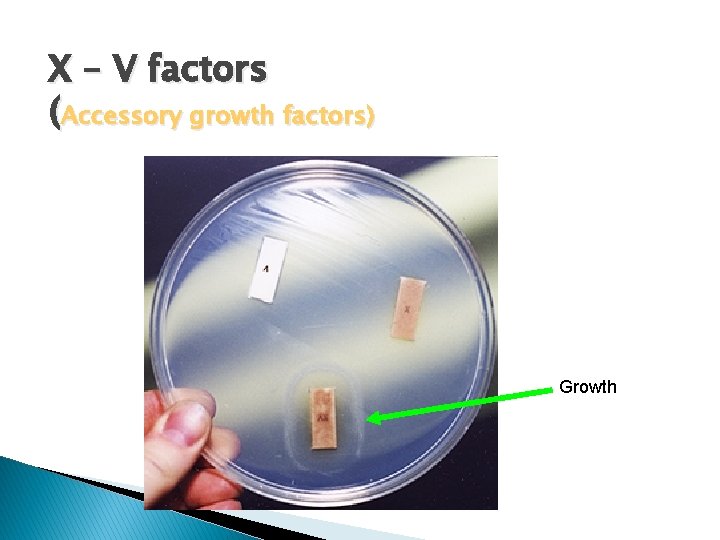X – V factors (Accessory growth factors) Growth 