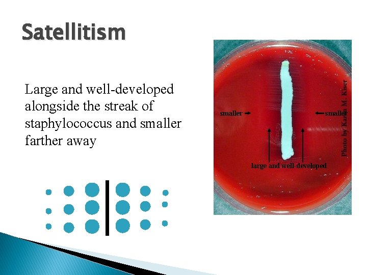 Satellitism Large and well-developed alongside the streak of staphylococcus and smaller farther away smaller