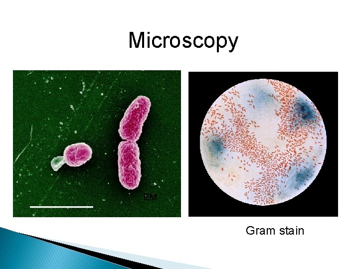  Microscopy EM Gram stain 