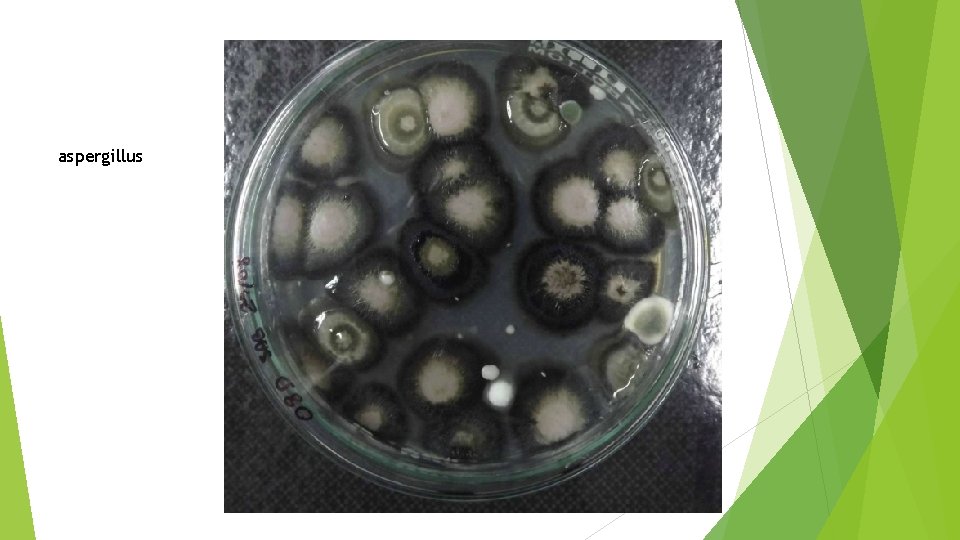 aspergillus aspergillus