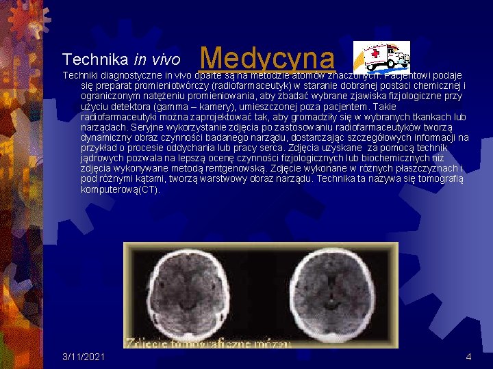 Technika in vivo Medycyna Techniki diagnostyczne in vivo oparte są na metodzie atomów znaczonych. Technika in vivo Medycyna Techniki diagnostyczne in vivo oparte są na metodzie atomów znaczonych.