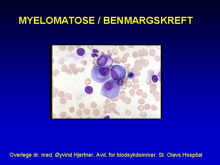 MYELOMATOSE / BENMARGSKREFT Overlege dr. med. Øyvind Hjertner, Avd. for blodsykdommer, St. Olavs Hospital