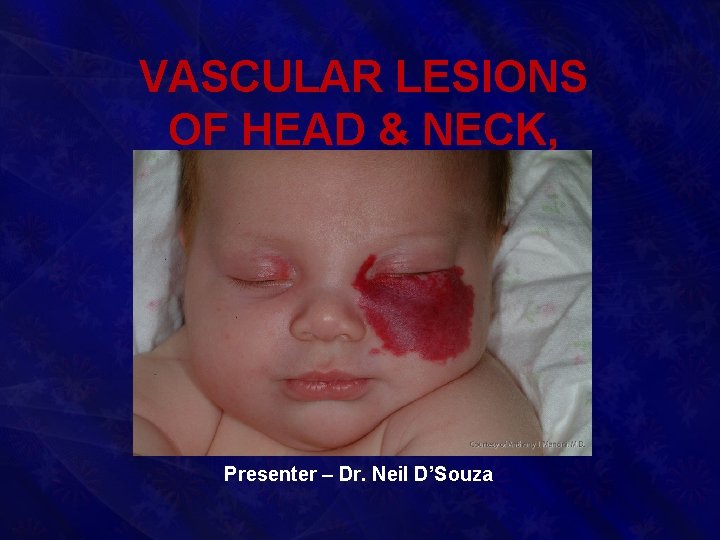 VASCULAR LESIONS OF HEAD & NECK, BED SORES Presenter – Dr. Neil D’Souza 