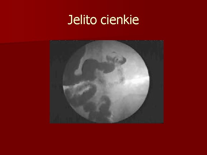 Jelito cienkie 