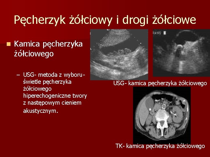 Pęcherzyk żółciowy i drogi żółciowe n Kamica pęcherzyka żółciowego – USG- metoda z wyboruświetle