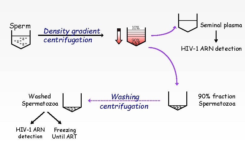 Sperm Density gradient centrifugation Washed Spermatozoa HIV-1 ARN detection Freezing Until ART 10% Seminal