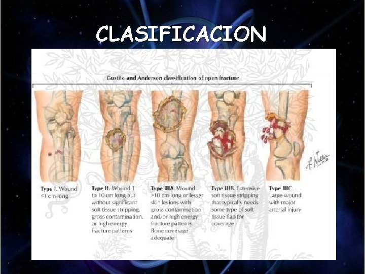 CLASIFICACION CLASIFICACION