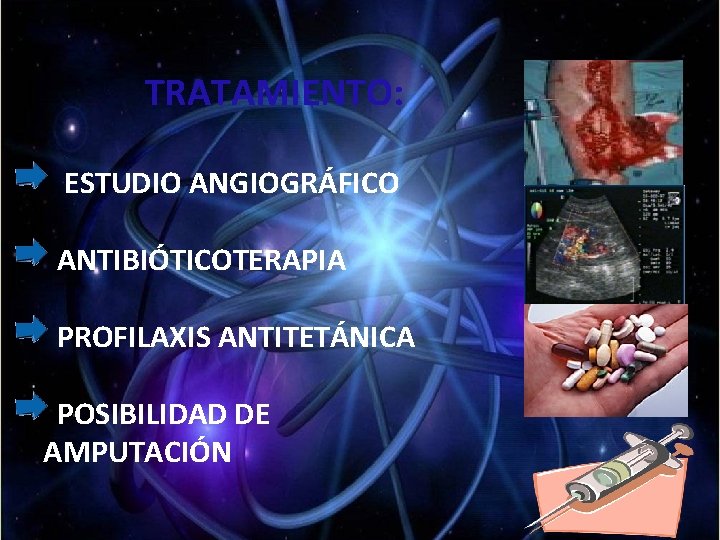TRATAMIENTO: ESTUDIO ANGIOGRÁFICO ANTIBIÓTICOTERAPIA PROFILAXIS ANTITETÁNICA POSIBILIDAD DE AMPUTACIÓN TRATAMIENTO: ESTUDIO ANGIOGRÁFICO ANTIBIÓTICOTERAPIA PROFILAXIS ANTITETÁNICA POSIBILIDAD DE AMPUTACIÓN