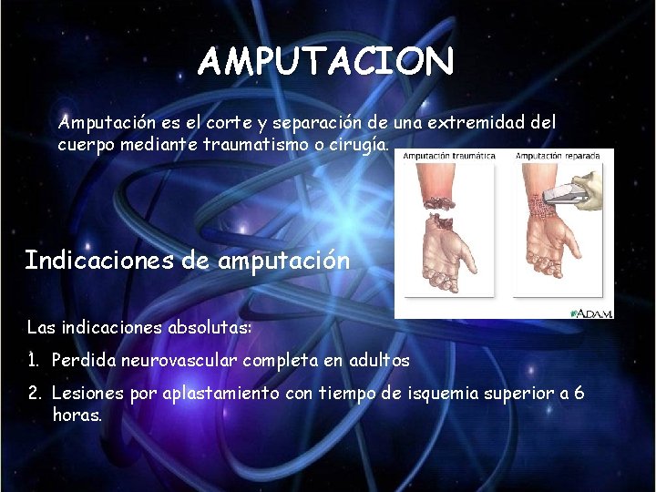 AMPUTACION Amputación es el corte y separación de una extremidad del cuerpo mediante traumatismo AMPUTACION Amputación es el corte y separación de una extremidad del cuerpo mediante traumatismo