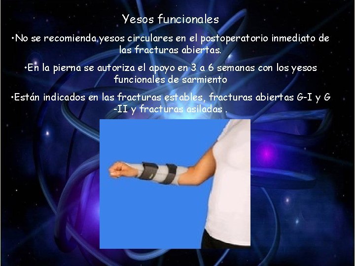 Yesos funcionales • No se recomienda yesos circulares en el postoperatorio inmediato de las Yesos funcionales • No se recomienda yesos circulares en el postoperatorio inmediato de las