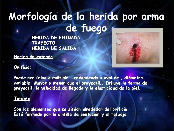Morfología de la herida por arma de fuego § HERIDA DE ENTRADA § TRAYECTO Morfología de la herida por arma de fuego § HERIDA DE ENTRADA § TRAYECTO