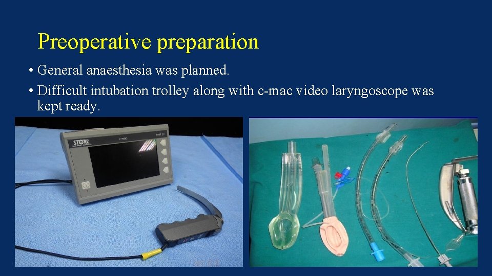 Preoperative preparation • General anaesthesia was planned. • Difficult intubation trolley along with c-mac
