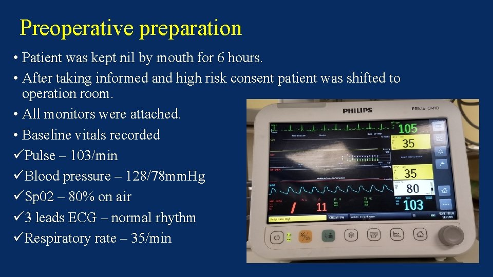 Preoperative preparation • Patient was kept nil by mouth for 6 hours. • After