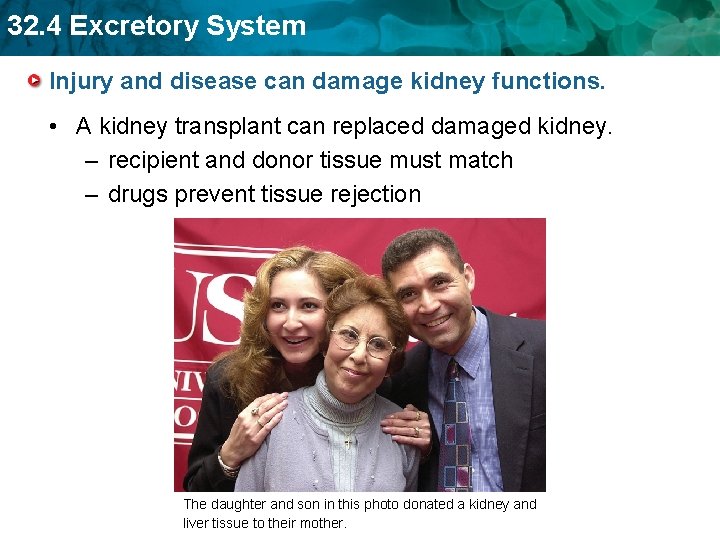 32. 4 Excretory System Injury and disease can damage kidney functions. • A kidney