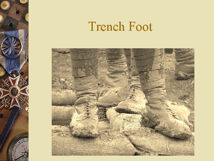 Trench Foot 