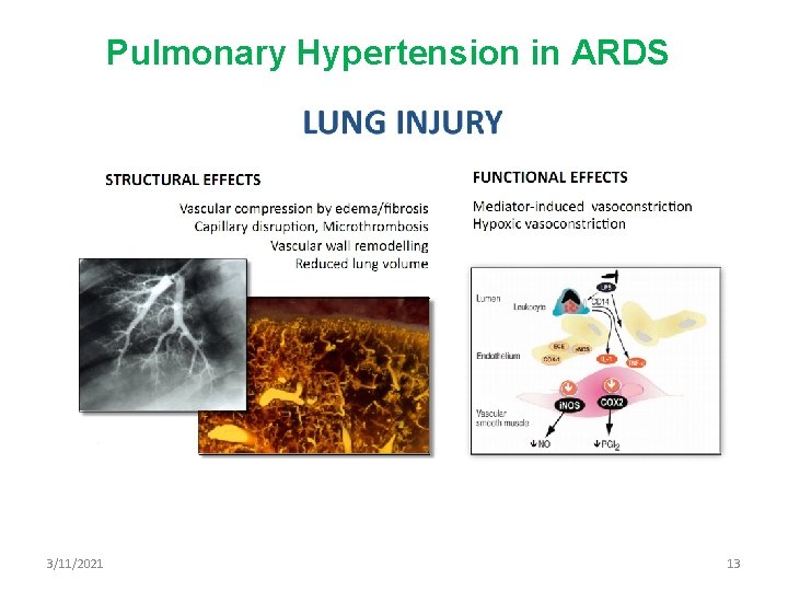Pulmonary Hypertension in ARDS 3/11/2021 13 