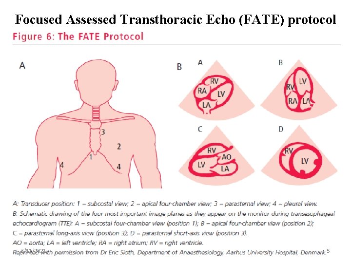 Focused Assessed Transthoracic Echo (FATE) protocol 3/11/2021 5 