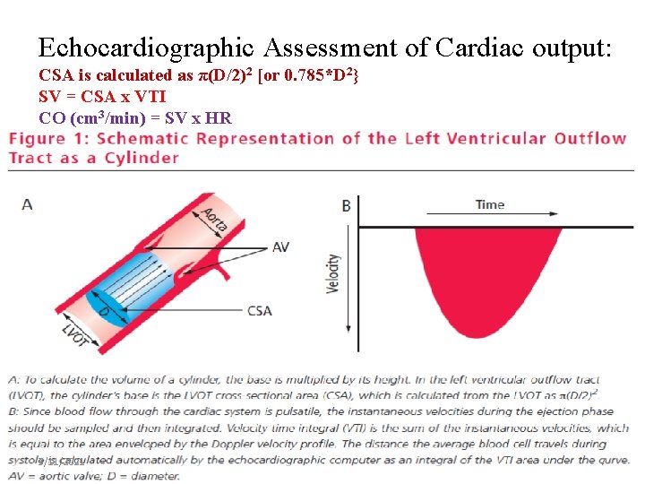 Echocardiographic Assessment of Cardiac output: CSA is calculated as π(D/2)2 [or 0. 785*D 2}