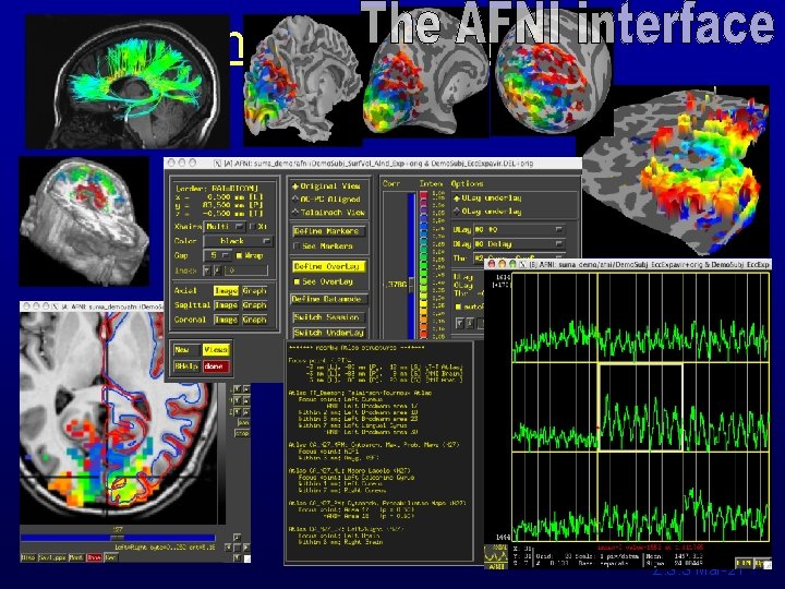 The AFNI interface Z. S. S Mar-21 