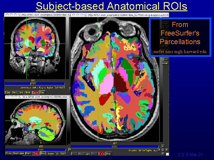Subject-based Anatomical ROIs From Free. Surfer's Parcellations surfer. nmr. mgh. harvard. edu Z. S.