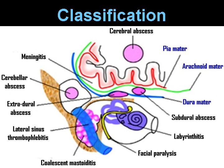 Classification 