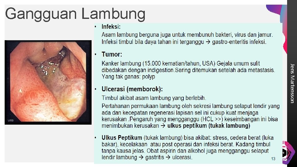 Gangguan Lambung Jens Martensson 16 