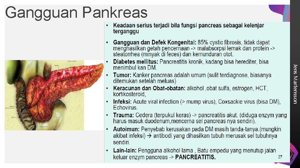 Gangguan Pankreas Jens Martensson 28 