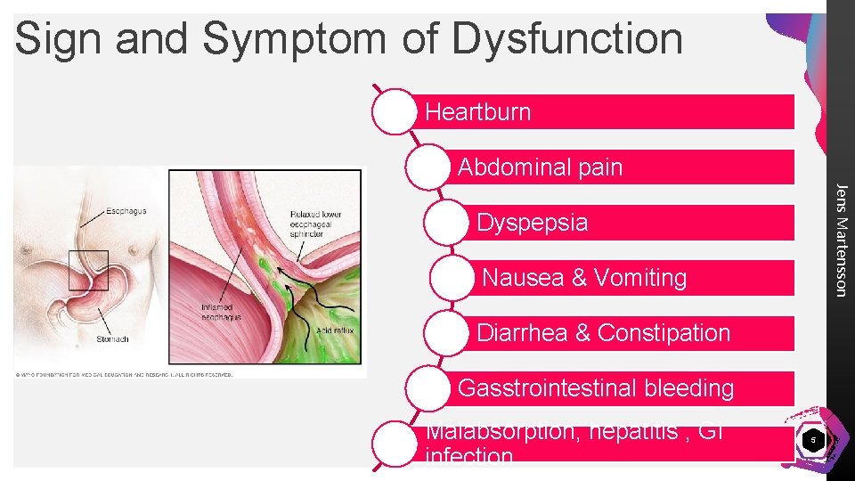 Sign and Symptom of Dysfunction Heartburn Abdominal pain Jens Martensson Dyspepsia Nausea & Vomiting