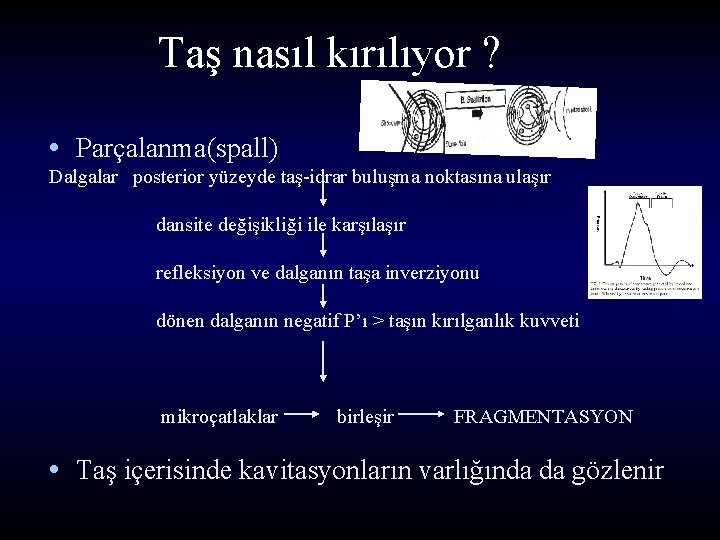 Taş nasıl kırılıyor ? • Parçalanma(spall) Dalgalar posterior yüzeyde taş-idrar buluşma noktasına ulaşır dansite