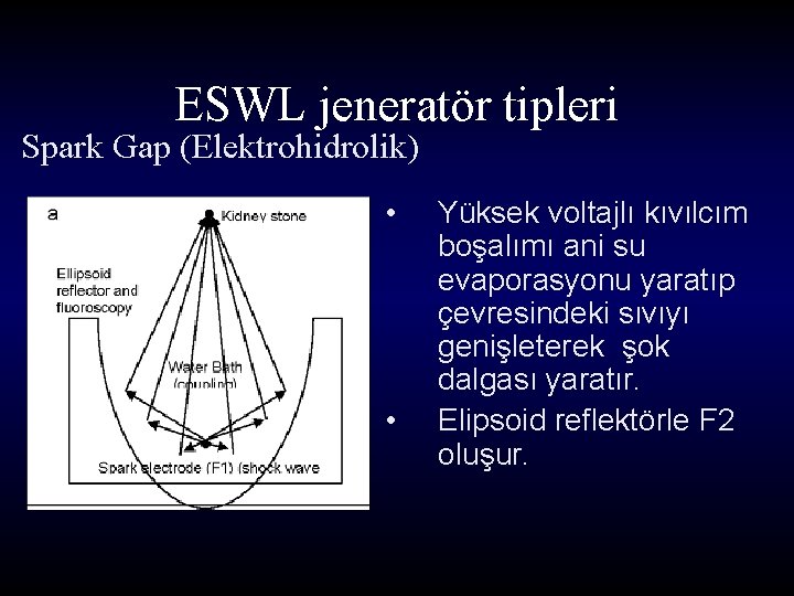 ESWL jeneratör tipleri Spark Gap (Elektrohidrolik) • • Yüksek voltajlı kıvılcım boşalımı ani su