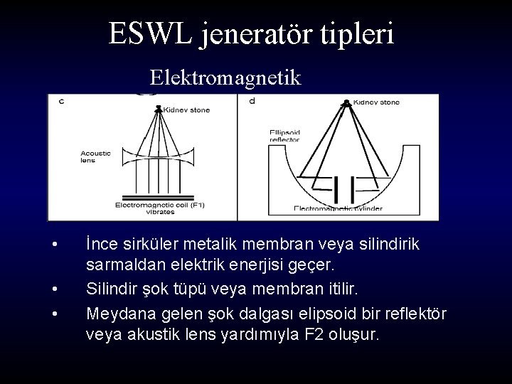 ESWL jeneratör tipleri Elektromagnetik • • • İnce sirküler metalik membran veya silindirik sarmaldan