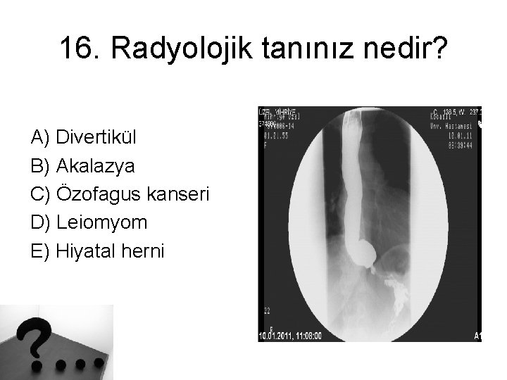 16. Radyolojik tanınız nedir? A) Divertikül B) Akalazya C) Özofagus kanseri D) Leiomyom E)