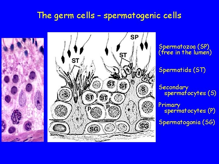 The germ cells – spermatogenic cells Spermatozoa (SP) (free in the lumen) Spermatids (ST)