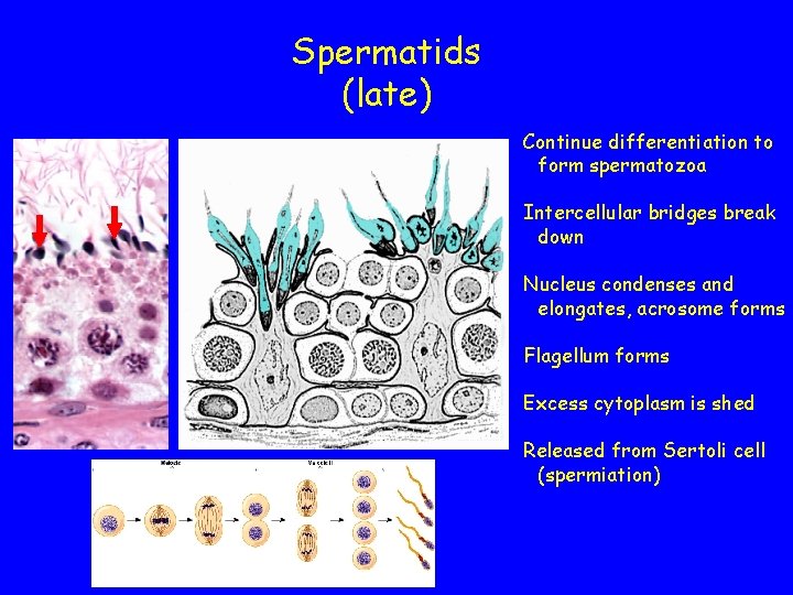 Spermatids (late) Continue differentiation to form spermatozoa Intercellular bridges break down Nucleus condenses and