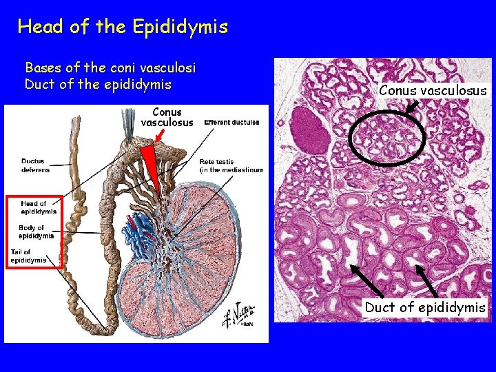 Head of the Epididymis Bases of the coni vasculosi Duct of the epididymis Conus