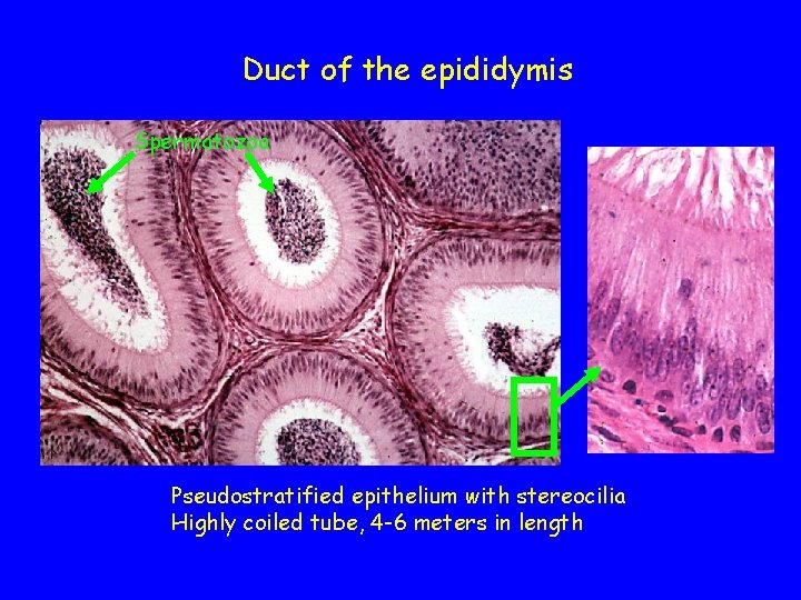 Duct of the epididymis Spermatozoa Pseudostratified epithelium with stereocilia Highly coiled tube, 4 -6