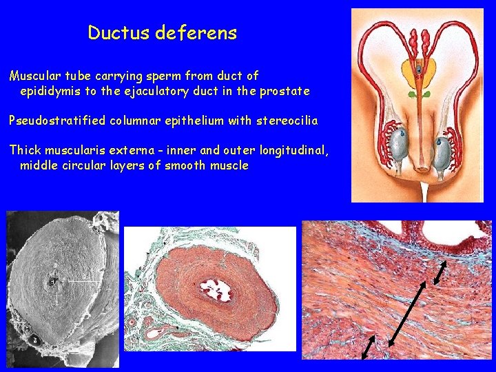 Ductus deferens Muscular tube carrying sperm from duct of epididymis to the ejaculatory duct