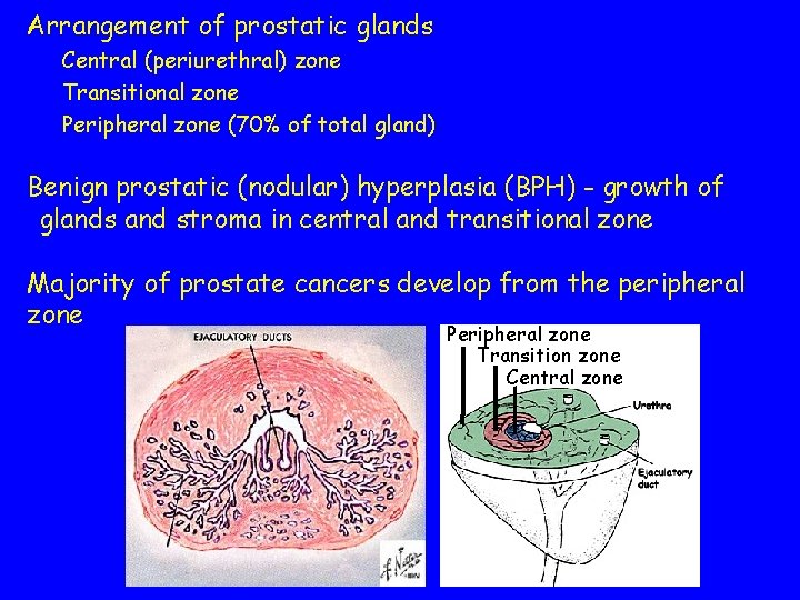 Arrangement of prostatic glands Central (periurethral) zone Transitional zone Peripheral zone (70% of total