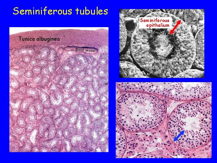 Seminiferous tubules Tunica albuginea Blood vessel Seminiferous epithelium 