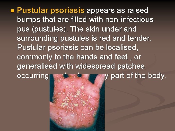 n Pustular psoriasis appears as raised bumps that are filled with non-infectious pus (pustules).