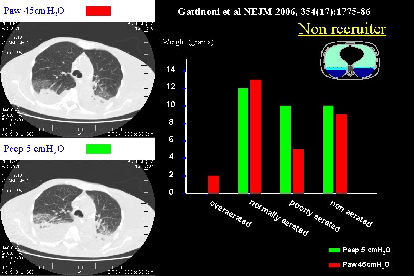 Paw 45 cm. H 2 O Gattinoni et al NEJM 2006, 354(17): 1775 -86