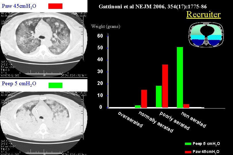Paw 45 cm. H 2 O Gattinoni et al NEJM 2006, 354(17): 1775 -86