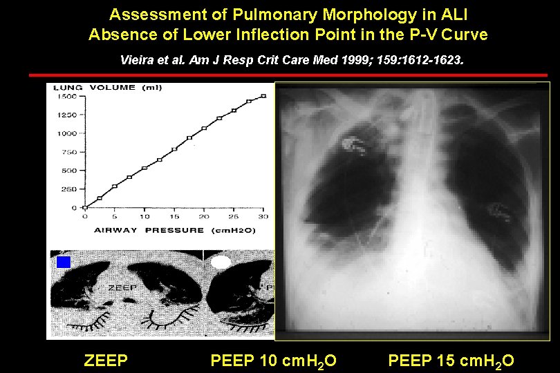 Assessment of Pulmonary Morphology in ALI Absence of Lower Inflection Point in the P-V