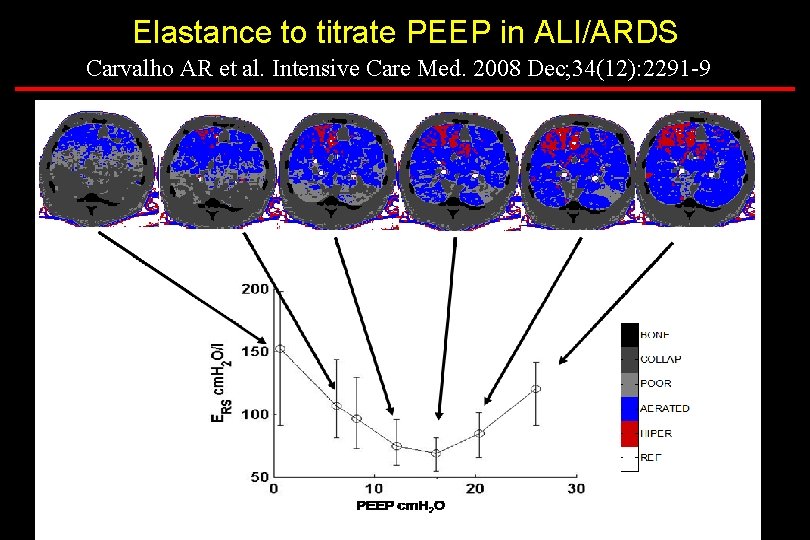 Elastance to titrate PEEP in ALI/ARDS Carvalho AR et al. Intensive Care Med. 2008